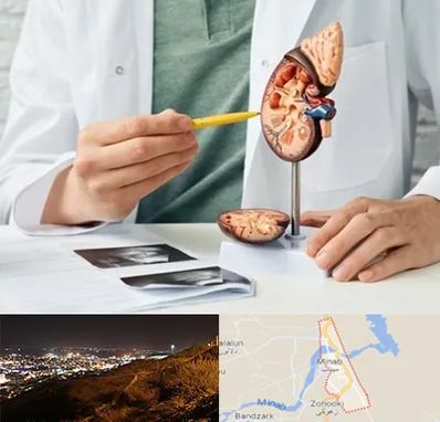 دکتر اورولوژیست در میناب