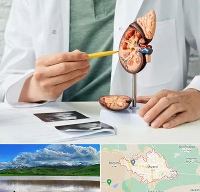 دکتر اورولوژیست در مرند