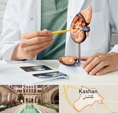 دکتر اورولوژیست در کاشان