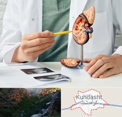 دکتر اورولوژیست در کوهدشت