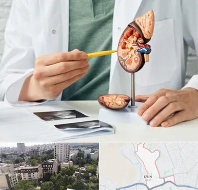 دکتر اورولوژیست در اوین