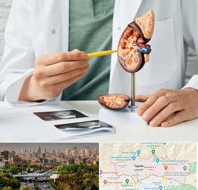 دکتر اورولوژیست در منطقه 1 تهران 