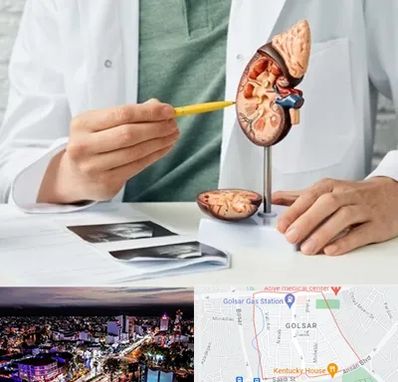 دکتر اورولوژیست در گلسار رشت 