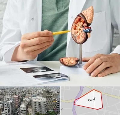 دکتر اورولوژیست در آذری