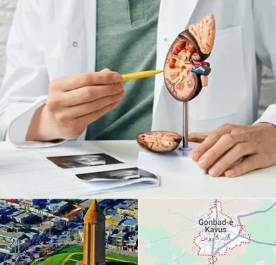 دکتر اورولوژیست در گنبد کاووس