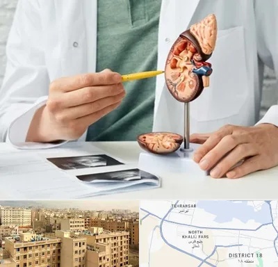 دکتر اورولوژیست در جنوب غرب تهران