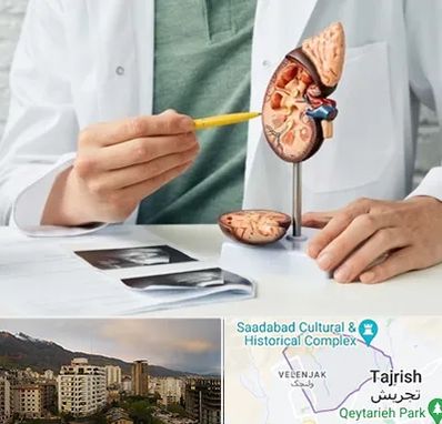 دکتر اورولوژیست در زعفرانیه 