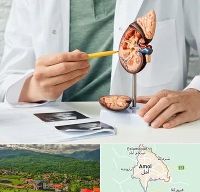 دکتر اورولوژیست در آمل