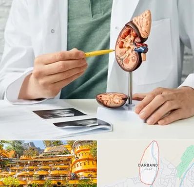 دکتر اورولوژیست در دربند