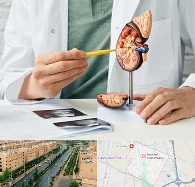 دکتر اورولوژیست در فاز سه اندیشه