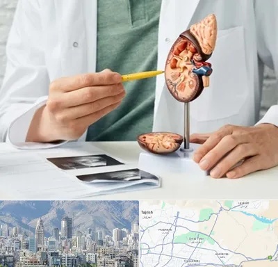 دکتر اورولوژیست در شمال شرق تهران
