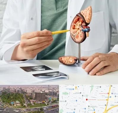 دکتر اورولوژیست در آیت الله کاشانی