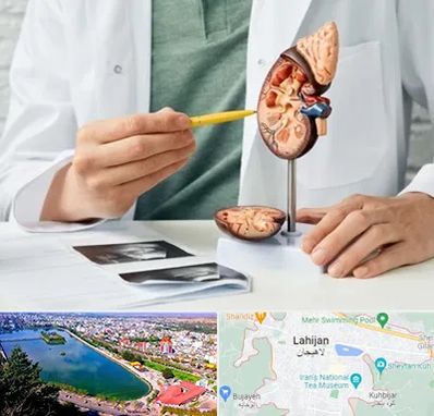 دکتر اورولوژیست در لاهیجان