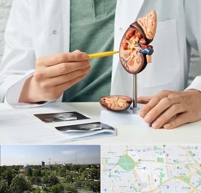 دکتر اورولوژیست در منطقه 16 تهران 