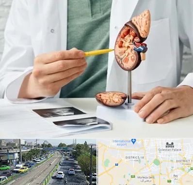 دکتر اورولوژیست در جنوب تهران 