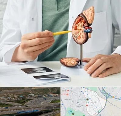 دکتر اورولوژیست در یاغچیان تبریز