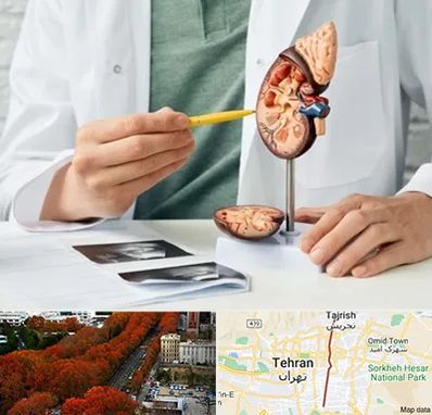 دکتر اورولوژیست در ولیعصر 