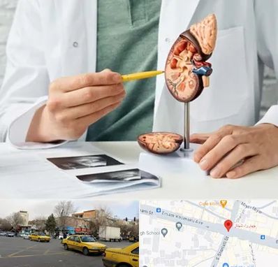 دکتر اورولوژیست در شهناز تبریز
