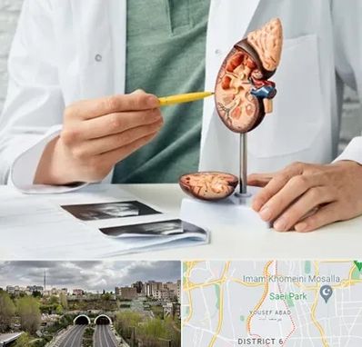 دکتر اورولوژیست در یوسف آباد 