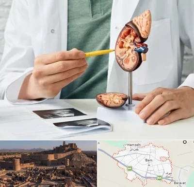 دکتر اورولوژیست در بم