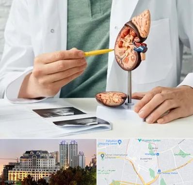 دکتر اورولوژیست در فرشته 