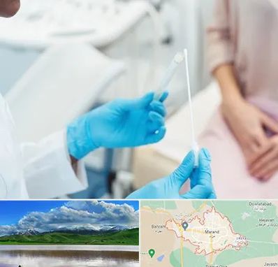 دکتر زگیل تناسلی HPV در مرند