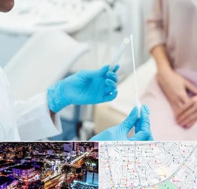 دکتر زگیل تناسلی HPV در منظریه رشت 