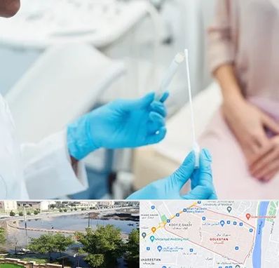 دکتر زگیل تناسلی HPV در گلستان اهواز 