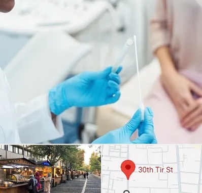 دکتر زگیل تناسلی HPV در سی تیر
