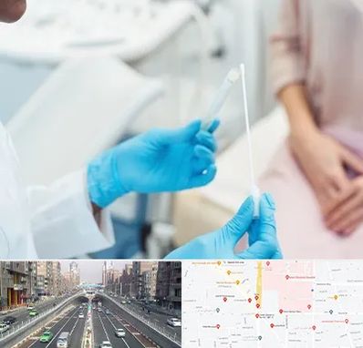 دکتر زگیل تناسلی HPV در توحید 