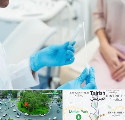 دکتر زگیل تناسلی HPV در تجریش 