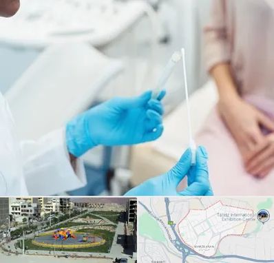 دکتر زگیل تناسلی HPV در مرزداران تبریز