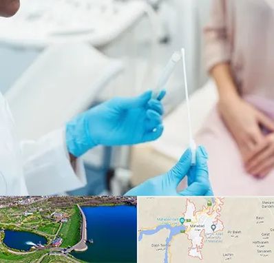 دکتر زگیل تناسلی HPV در مهاباد