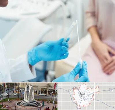 دکتر زگیل تناسلی HPV در زابل