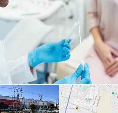 دکتر زگیل تناسلی HPV در فاز دو اندیشه