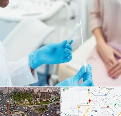 دکتر زگیل تناسلی HPV در سبلان 