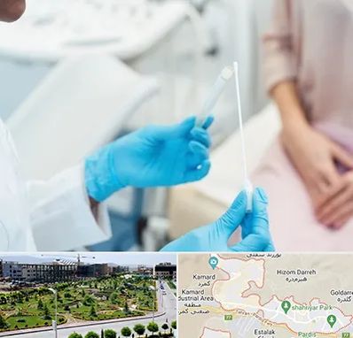 دکتر زگیل تناسلی HPV در پردیس