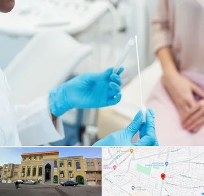 دکتر زگیل تناسلی HPV در زنبیل آباد قم