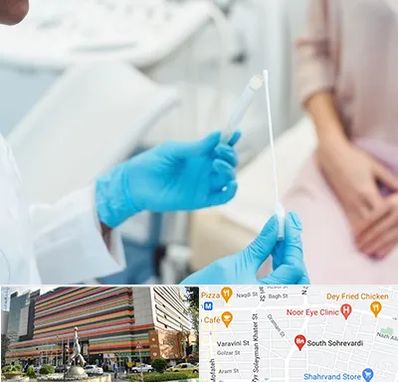 دکتر زگیل تناسلی HPV در سهروردی 