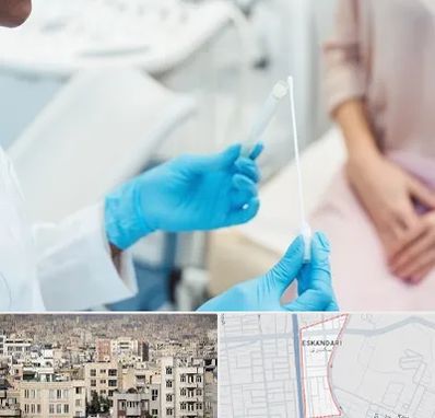 دکتر زگیل تناسلی HPV در اسکندری