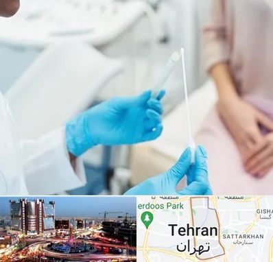 دکتر زگیل تناسلی HPV در صادقیه 