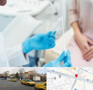 دکتر زگیل تناسلی HPV در شهناز تبریز