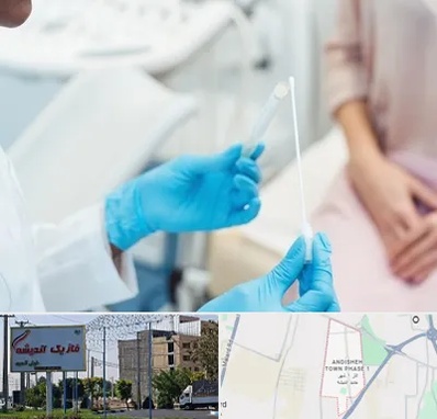 دکتر زگیل تناسلی HPV در فاز یک اندیشه