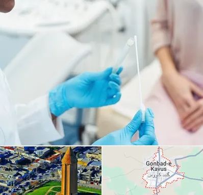 دکتر زگیل تناسلی HPV در گنبد کاووس