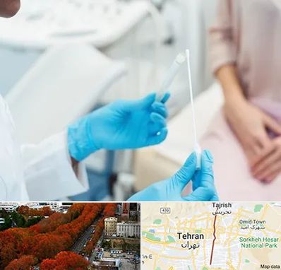 دکتر زگیل تناسلی HPV در ولیعصر 