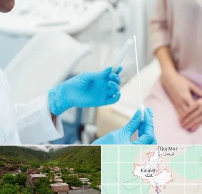 دکتر زگیل تناسلی HPV در کلاله