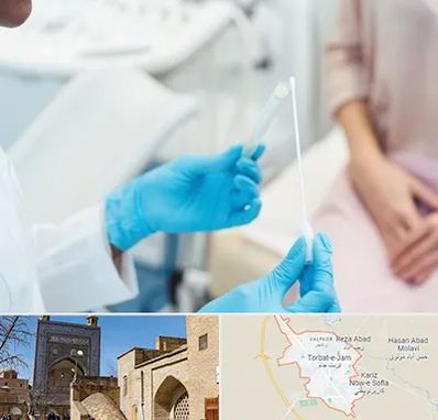 دکتر زگیل تناسلی HPV در تربت جام