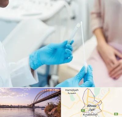 دکتر زگیل تناسلی HPV در اهواز