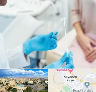 دکتر زگیل تناسلی HPV در میانه