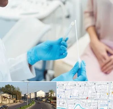 دکتر زگیل تناسلی HPV در ضیابری رشت 